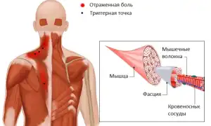 Боли в спине по утрам: причины и рекомендации