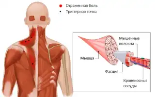 Боли в спине по утрам: причины и рекомендации