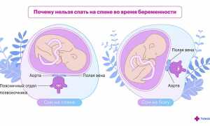 Сон на спине во время беременности: чем он опасен для здоровья?