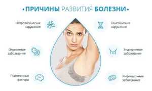 Что такое гипергидроз и как он возникает: причины и симптомы