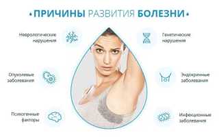 Что такое гипергидроз и как он возникает: причины и симптомы