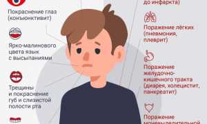 Как распознать болезнь Кавасаки у ребенка? Полезные советы и рекомендации