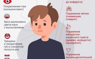 Как распознать болезнь Кавасаки у ребенка? Полезные советы и рекомендации