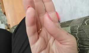 Судороги в кистях руки: причины и последствия
