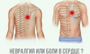 Что вызывает боль в груди. Всегда ли это сердце? Узнайте причины и симптомы