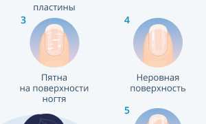 Какие витамины нужны для здоровья ногтей, выбираем самые нужные и эффективные для красоты