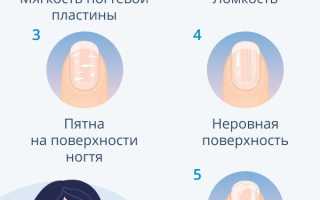 Какие витамины нужны для здоровья ногтей, выбираем самые нужные и эффективные для красоты