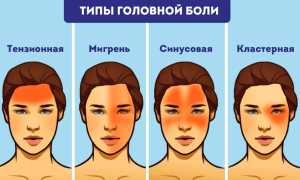 Головные боли при остеохондрозе: как часто они встречаются и что с этим делать?