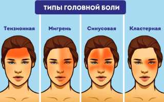 Головные боли при остеохондрозе: как часто они встречаются и что с этим делать?