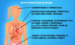 Вегетососудистая дистония: бывает ли такая болезнь и как с ней бороться?