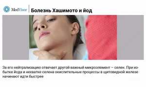 Аутоиммунный тиреоидит (Болезнь Хашимото): как он связан с приемом йода? Важные аспекты здоровья