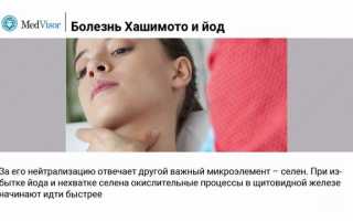 Аутоиммунный тиреоидит (Болезнь Хашимото): как он связан с приемом йода? Важные аспекты здоровья