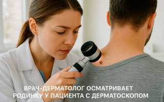 К какому врачу обратиться, чтобы удалить родинку безопасно и эффективно?