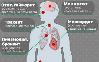 Может ли грипп спровоцировать инфаркт и другие осложнения?