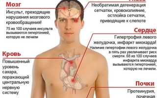 Что такое гипертонический криз, последствия для здоровья и его лечение