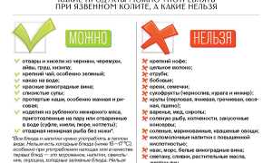 Как лечить обострение язвенного колита? Полезные советы и рекомендации