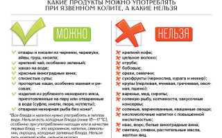Как лечить обострение язвенного колита? Полезные советы и рекомендации
