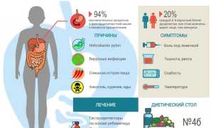 Что такое дуоденит и как он появляется, лечение и диета: основные аспекты