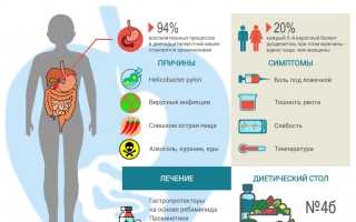 Что такое дуоденит и как он появляется, лечение и диета: основные аспекты