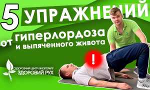 Гиперлордоз поясницы: упражнения для коррекции и укрепления
