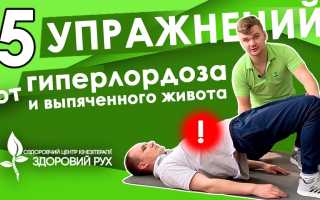 Гиперлордоз поясницы: упражнения для коррекции и укрепления