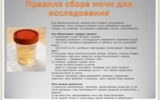 Что нельзя есть перед сдачей мочи беременным