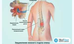 Почему устает спина при долгой ходьбе или стоянии на одном месте? Узнайте причины и решения