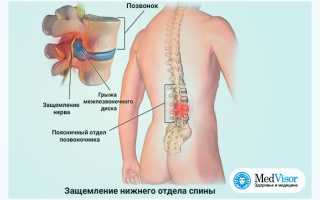 Почему устает спина при долгой ходьбе или стоянии на одном месте? Узнайте причины и решения