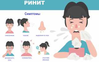 Аллергический ринит: симптомы и лечение у взрослых
