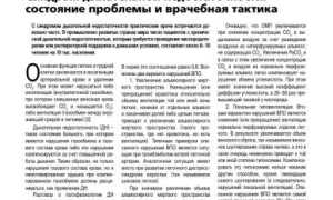Как проявляется синдром дыхательной недостаточности? Полное руководство