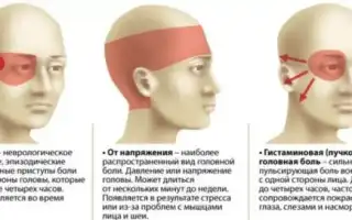Болит голова во время тренировок: с чем это связано и как лечить? Полезные советы