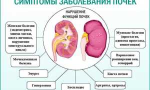 Основные симптомы заболеваний почек и их последствия