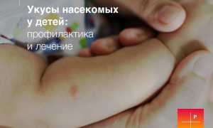 Ребенок чешет укус комара: что делать в такой ситуации?