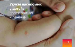 Ребенок чешет укус комара: что делать в такой ситуации?