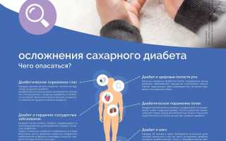 Падает зрение при диабете. Что нужно знать для сохранения здоровья?