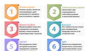 Диагностика рака груди. Ответы на шесть главных вопросов для женщин