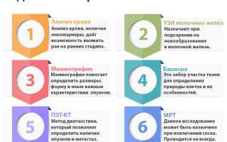 Диагностика рака груди. Ответы на шесть главных вопросов для женщин