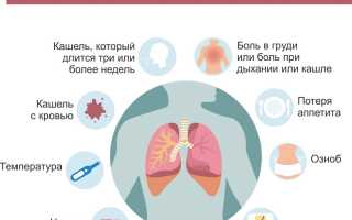 Туберкулез: излечим до конца или нет? Важные факты