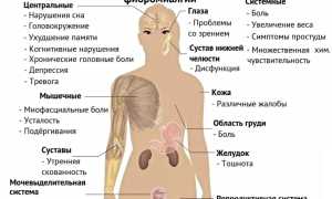 Хроническая боль в мышцах (фибромиалгия). Что это такое и как появляется? Полное руководство