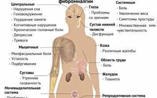 Хроническая боль в мышцах (фибромиалгия). Что это такое и как появляется? Полное руководство
