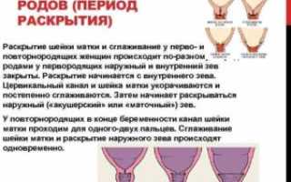 Сглажена шейка когда роды