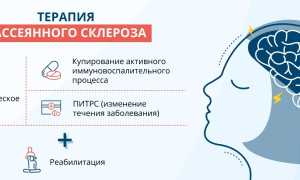 Как предотвратить развитие рассеянного склероза? Полезные советы и рекомендации