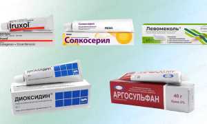 Мази для лечения трофических язв: обзор препаратов, список и рекомендации