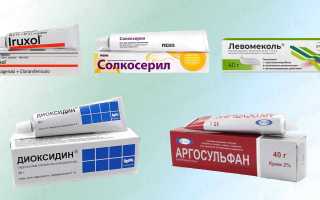 Мази для лечения трофических язв: обзор препаратов, список и рекомендации