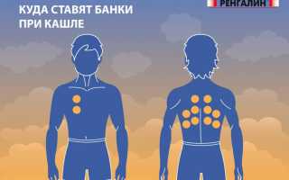 Как нужно правильно ставить банки на спину при кашле и бронхите для эффективного лечения