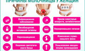 Молочница у женщин — причины и лечение, симптомы и профилактика