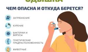 Беспричинная одышка у взрослого: почему она появляется, как лечить и что важно знать?