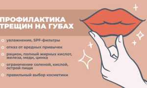 Почему трескаются губы и как это лечить? Полезные советы и рекомендации