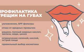 Почему трескаются губы и как это лечить? Полезные советы и рекомендации