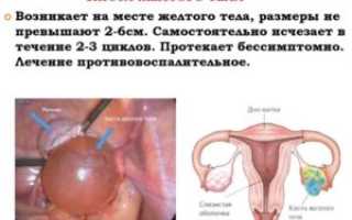 Яичники увеличиваются при беременности
